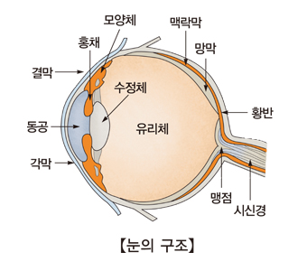 노안