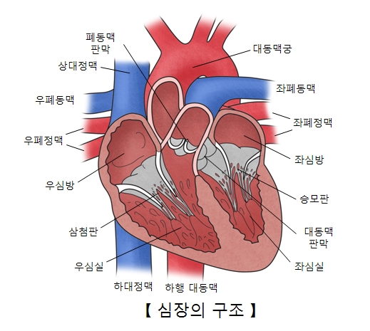 선천성 심장질환