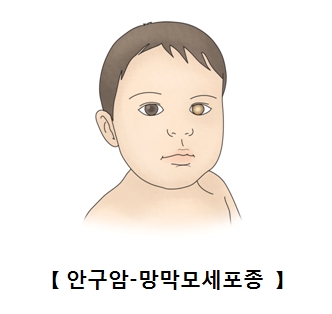 안암