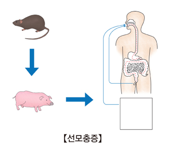 선모충증