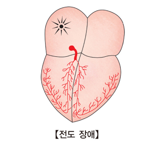 동기능부전증후군