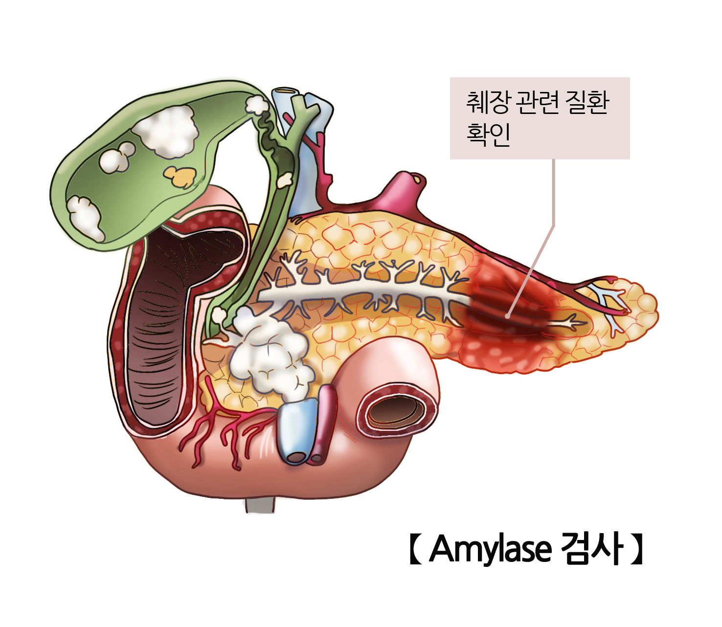 아밀라제