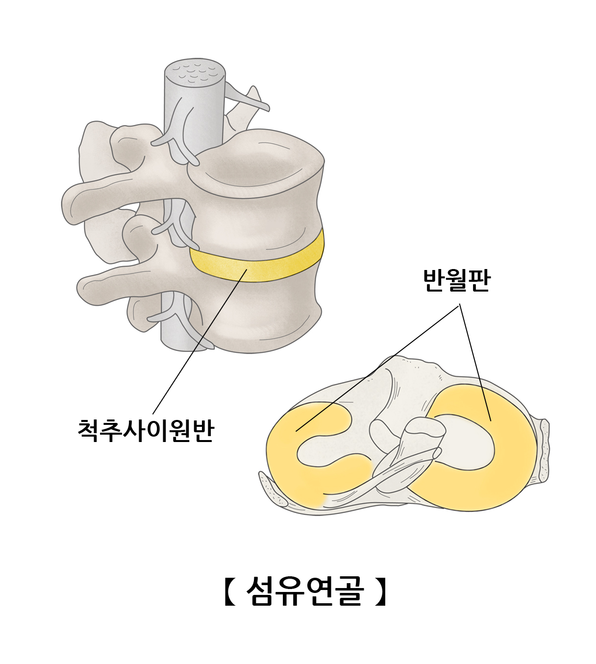 섬유연골